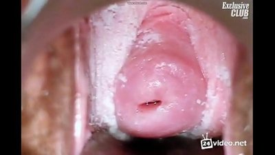 د یوې ښکلې میرمنې نسایی معاینه